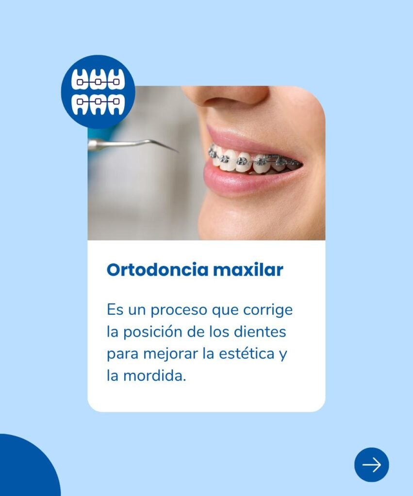 ortodonciamaxilar