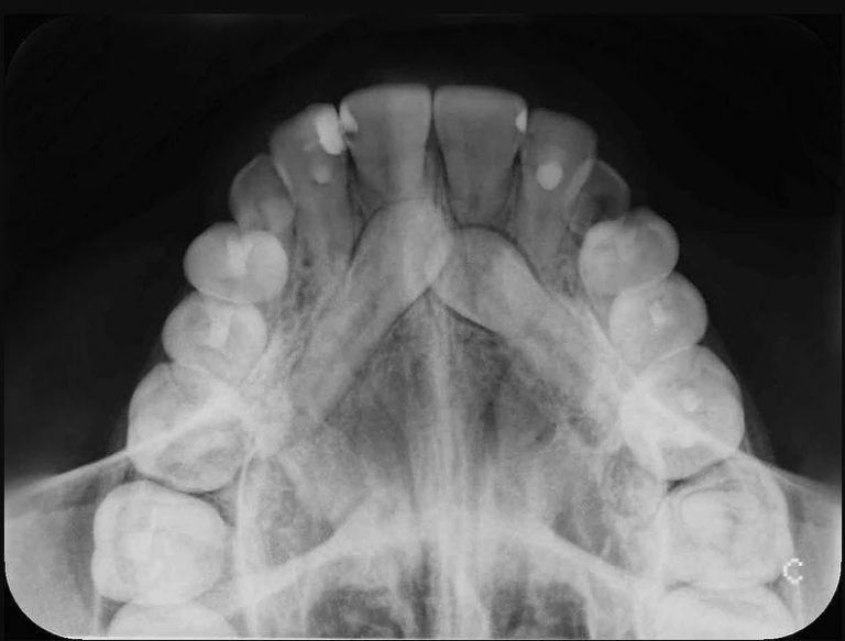 radiologia