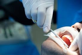 rehabilitacion